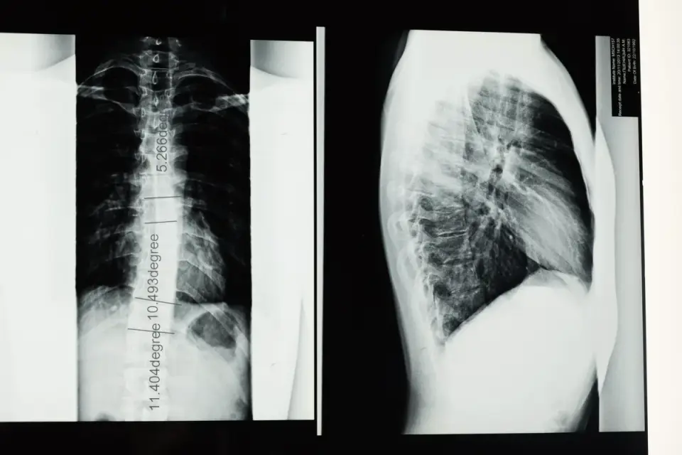 Veterinarian running hands along a senior dog&#x27;s spine to assess body condition